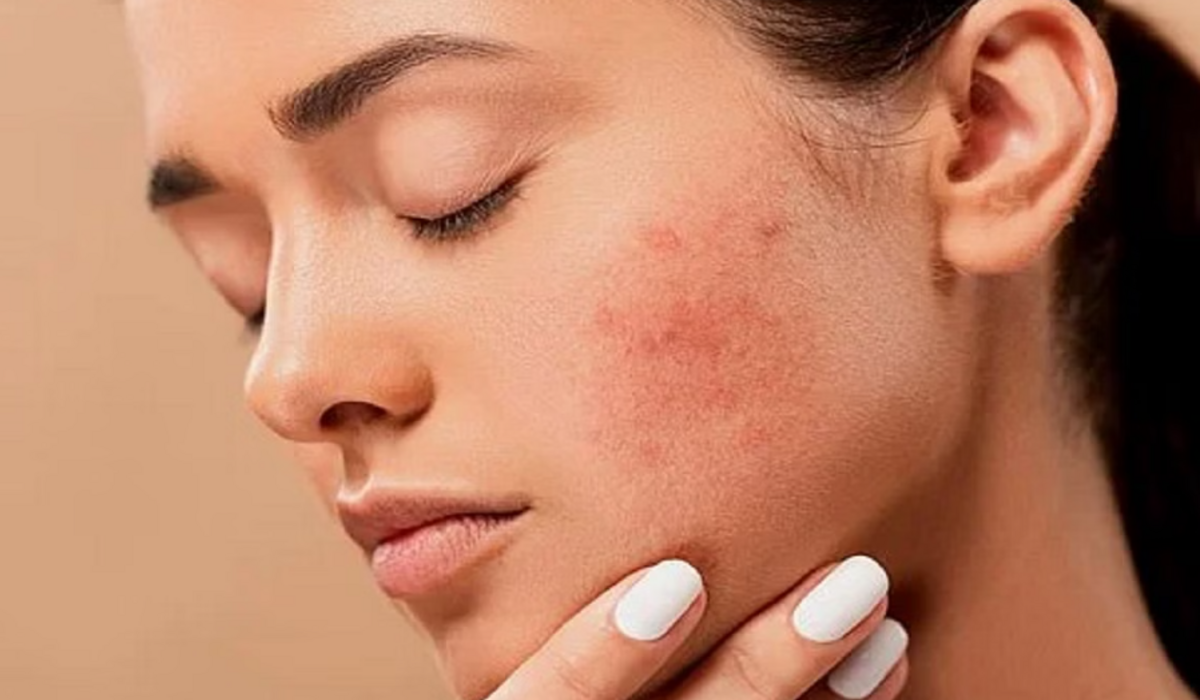 Skin care: चेहरे पर इन चीजों का इस्तेमाल करते हैं तो सावधान रहें, यह समस्या हो सकती...