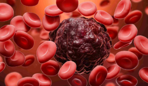 Blood Cancer: यदि किसी को रक्त कैंसर हो, तो उसके शरीर पर कौन-कौन से लक्षण दिखाई देंगे?